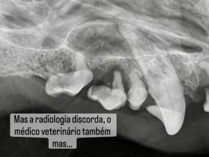 Dentisteria e Odontologia: Reabsorção dentária invisível após destartarização (imagem 3 de 3)