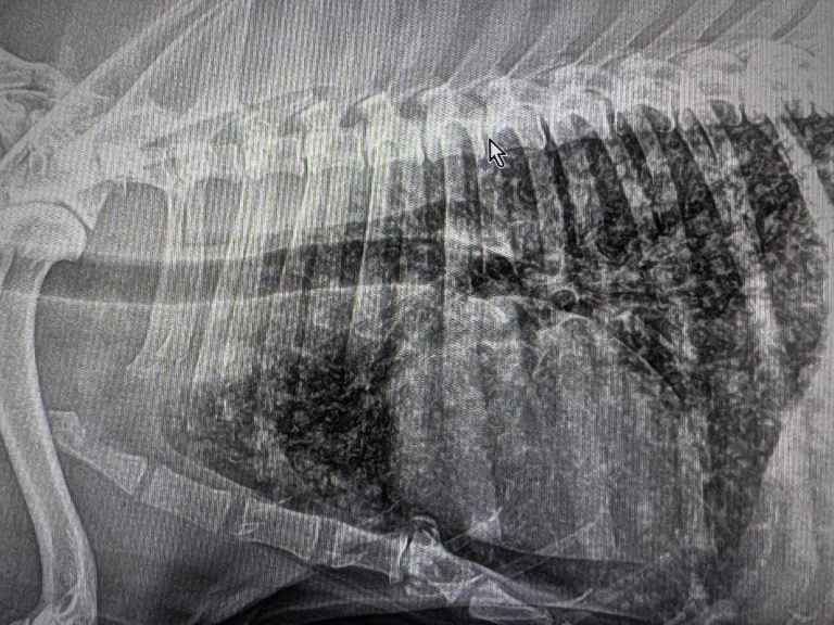 TAC: TAC no diagnóstico de metástases pulmonares (imagem 1 de 2)