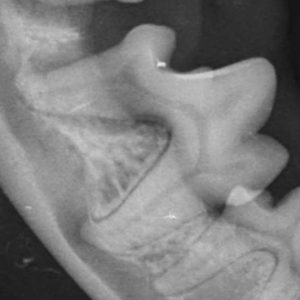 Dentisteria e Odontologia: Exodontia com raízes dilaceradas (imagem 1 de 3)