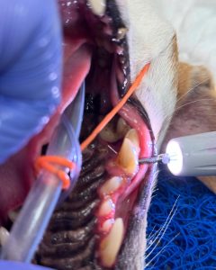 Dentisteria e Odontologia: Furca de grau 3 e exploração oral (imagem 1 de 2)