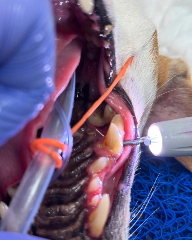 Dentisteria e Odontologia: Furca de grau 3 e exploração oral (imagem 1 de 2)