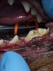 Dentisteria e Odontologia: Fratura do P4 e fístula infraorbitária (imagem 2 de 5)