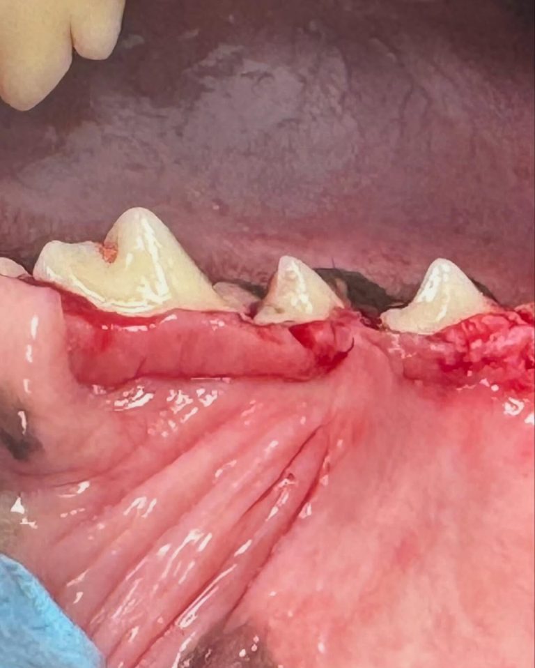 Dentisteria e Odontologia: Hiperplasia gengival em cães (imagem 1 de 4)