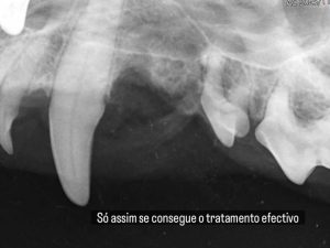 Dentisteria e Odontologia: Radiografias intra-orais no diagnóstico dentário (imagem 3 de 4)