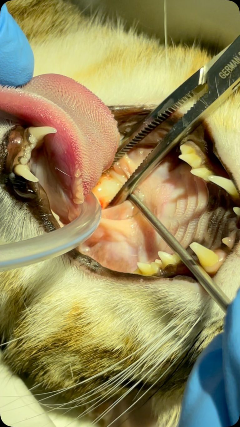 Endoscopia: Pólipos nasofaríngeos em forma de ovos da Páscoa
