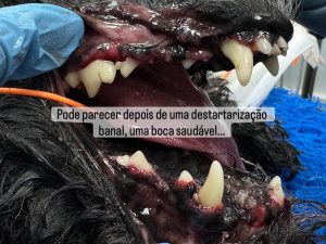 Dentisteria e Odontologia: Reabsorção dentária invisível após destartarização (imagem 2 de 3)