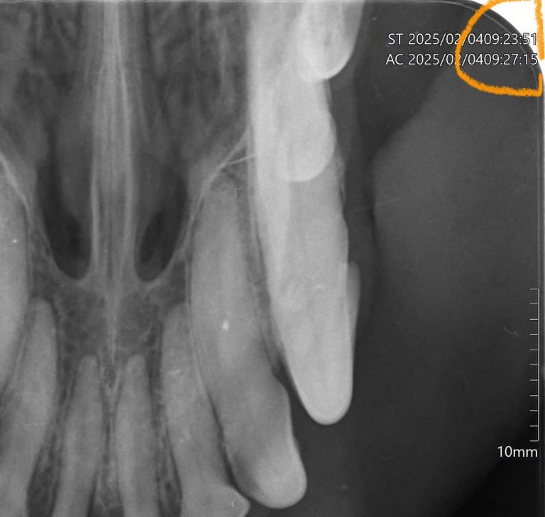Radiologia: Radiografias intraorais sem atrasar o tratamento (imagem 1 de 2)