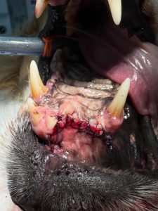 Oncologia: Ameloblastoma acantomatoso e margens cirúrgicas (imagem 3 de 3)