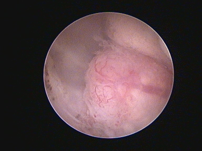 Oncologia: Carcinoma ceruminoso em gatos (imagem 1 de 3)