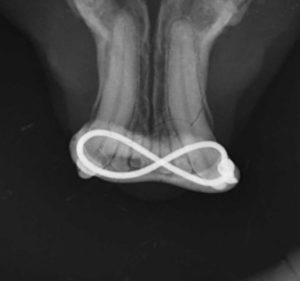 Dentisteria e Odontologia: Estabilização não invasiva da sínfise mandibular (imagem 2 de 3)