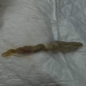 Endoscopia: Tricobezoares em gatos: quando preocupar (imagem 2 de 2)