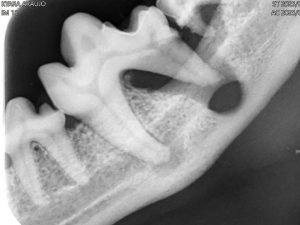 Dentisteria e Odontologia: Radiologia intraoral na doença periodontal (imagem 2 de 3)