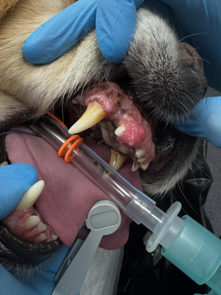 Oncologia: Ameloblastoma acantomatoso e margens cirúrgicas (imagem 1 de 3)