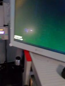 Endoscopia: Osso impactado no esófago removido por endoscopia (imagem 3 de 5)