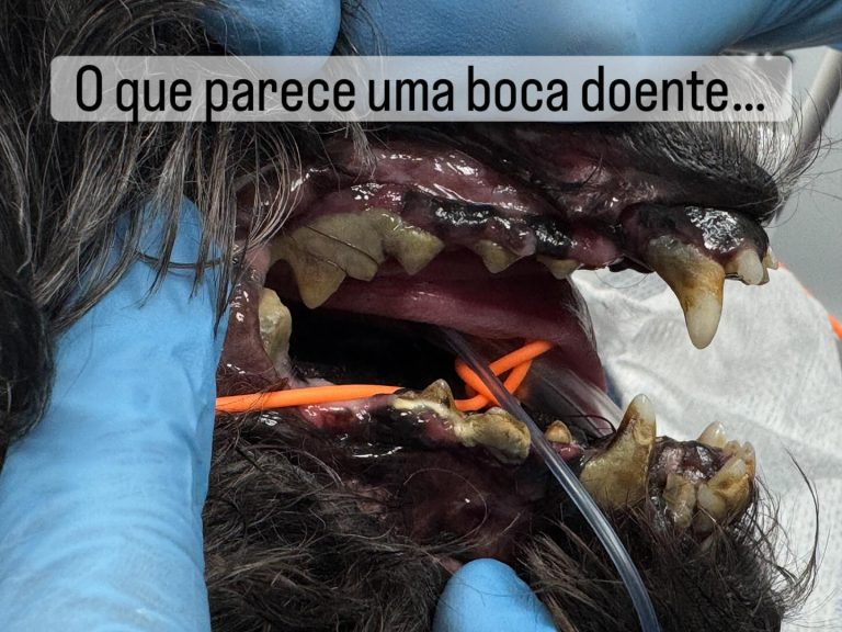 Dentisteria e Odontologia: Reabsorção dentária invisível após destartarização (imagem 1 de 3)