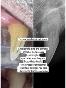 Dentisteria e Odontologia: Reabsorção dentária felina invisível à superfície (imagem 5 de 7)