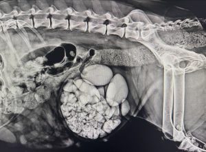 Medicina Interna: Cálculos na bexiga: como se formam (imagem 1 de 2)