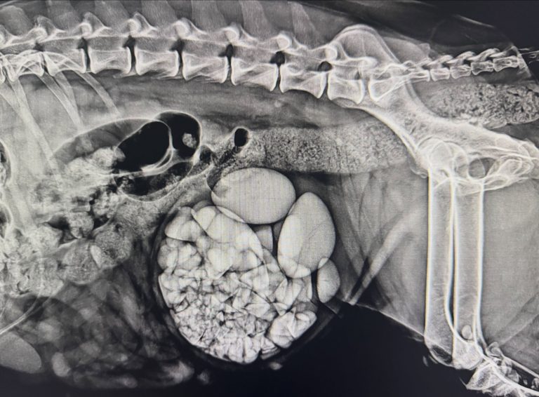 Medicina Interna: Cálculos na bexiga: como se formam (imagem 1 de 2)