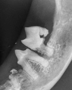 Dentisteria e Odontologia: Radiografia intraoral no tratamento periodontal (imagem 4 de 4)