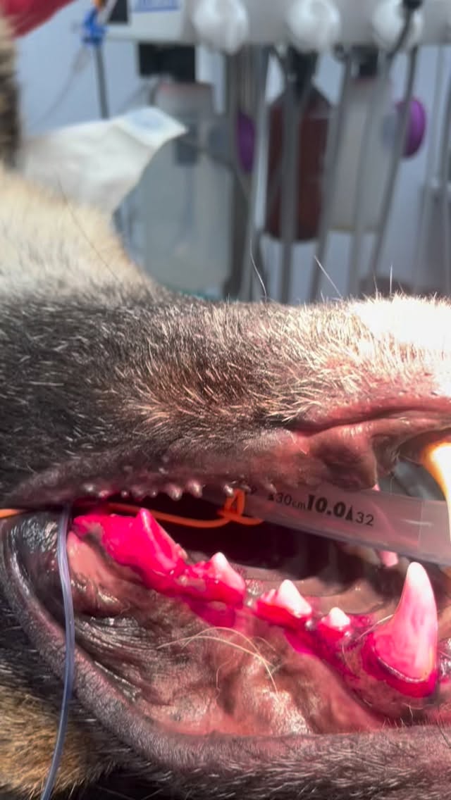 Dentisteria e Odontologia: A placa bacteriana e a doença periodontal