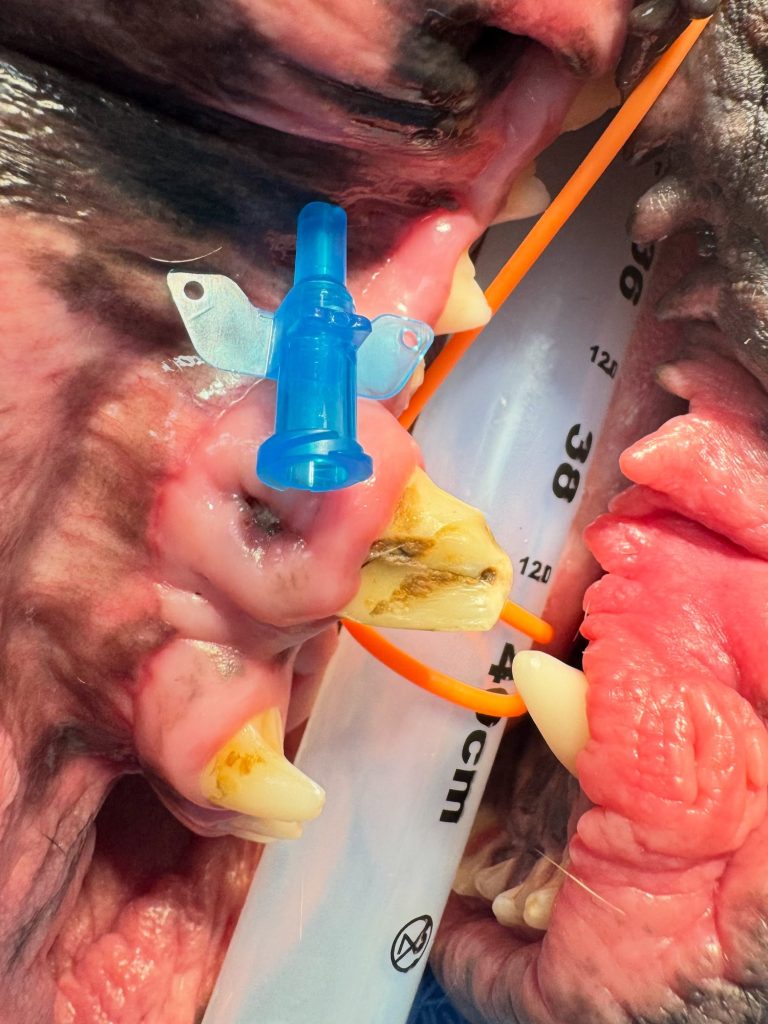 Dentisteria e Odontologia: Bloqueios loco-regionais em dentisteria (imagem 1 de 3)