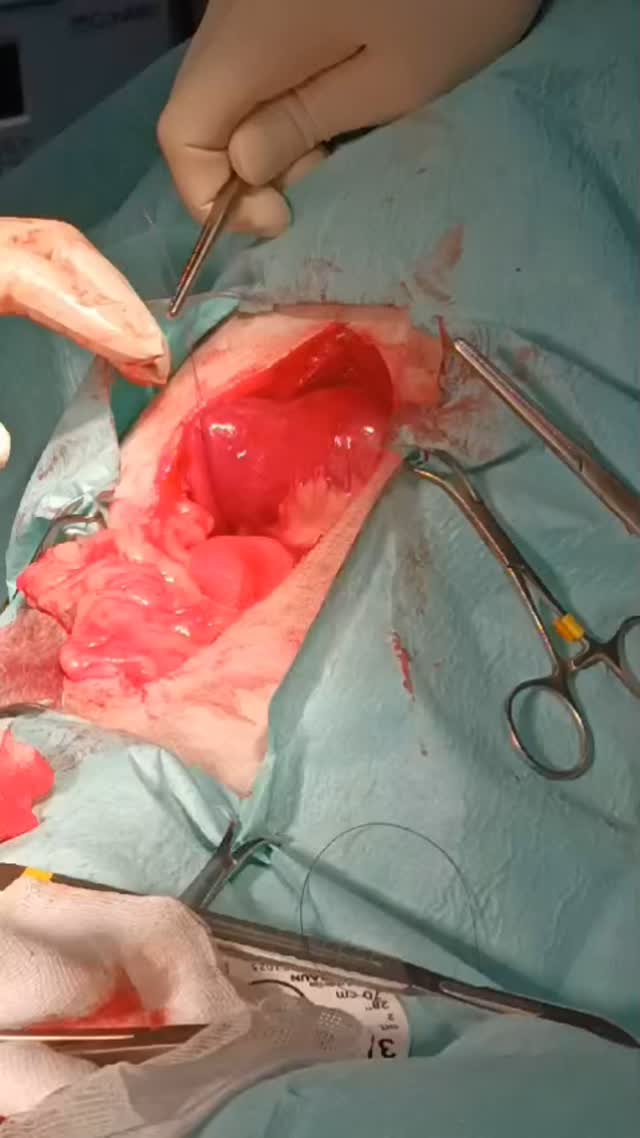 Medicina Interna: Corpo estranho assustador no intestino