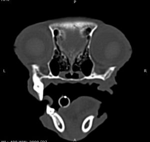 Dentisteria e Odontologia: Abcesso periapical e sinais respiratórios (imagem 4 de 4)
