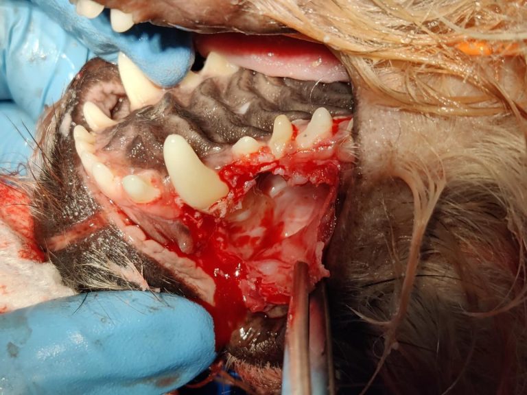 Dentisteria e Odontologia: Quistos dentígenos em dentes não erupcionados (imagem 1 de 2)