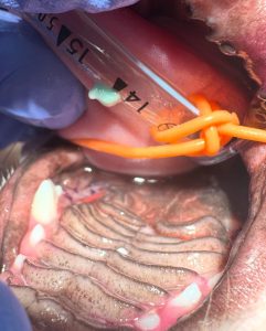 Dentisteria e Odontologia: Radiologia oral na doença periodontal (imagem 3 de 6)