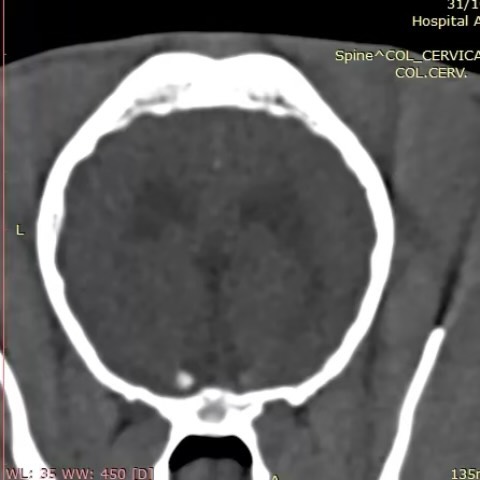 Imagiologia: Extrusão discal cervical em braquicefálicos (imagem 1 de 3)