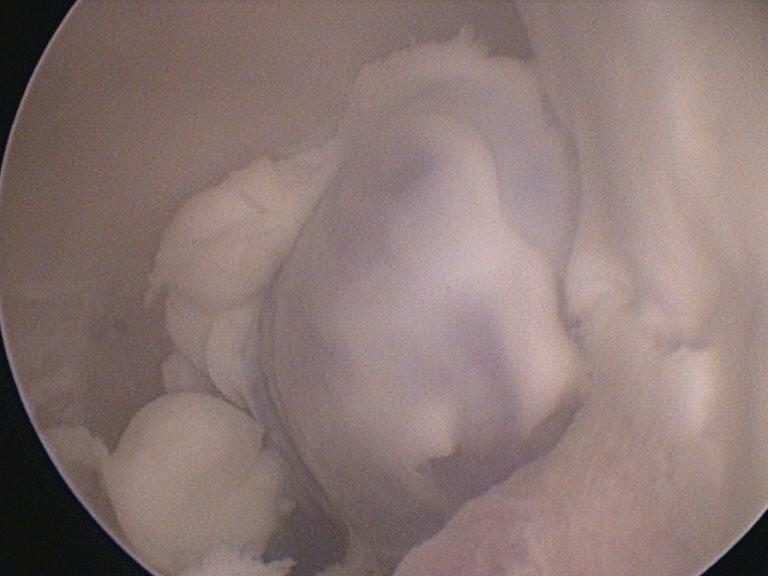 Endoscopia: Videotoscopia e laser na cistomatose felina (imagem 1 de 3)