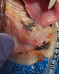 Dentisteria e Odontologia: Exodontia com fratura complicada (imagem 1 de 2)