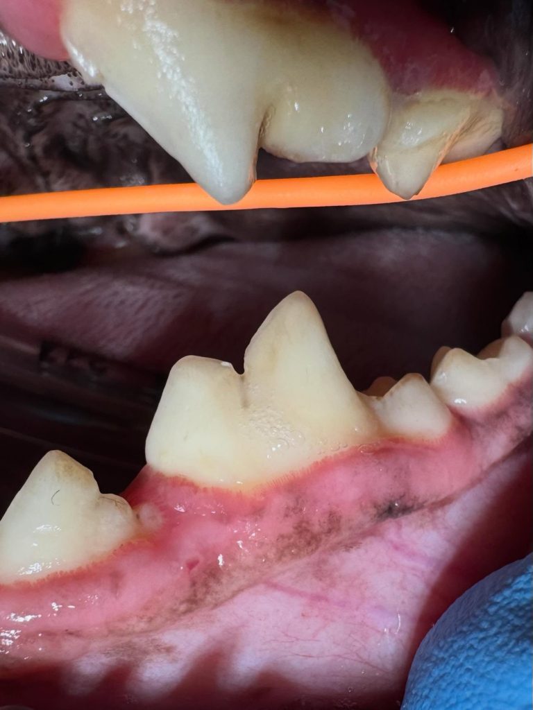 Dentisteria e Odontologia: Exodontia complexa com anquilose dentária (imagem 1 de 4)