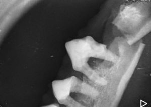 Dentisteria e Odontologia: Fraturas mandibulares e doença periodontal (imagem 2 de 2)