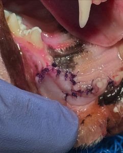 Dentisteria e Odontologia: Exodontia com fratura complicada (imagem 2 de 2)