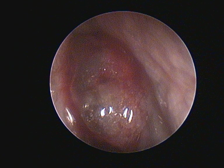Oncologia: Carcinoma nasal em cães (imagem 1 de 3)