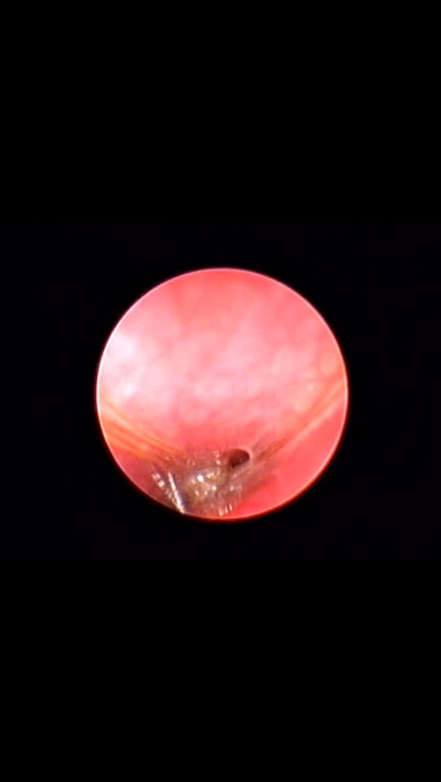 Endoscopia: Pragana nasal em cão