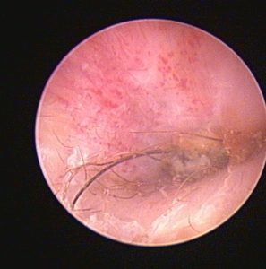 Medicina Interna: Braquicefalia e otites de difícil tratamento (imagem 3 de 3)