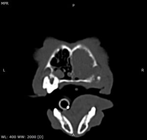 Dentisteria e Odontologia: Abcesso periapical e sinais respiratórios (imagem 1 de 4)