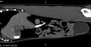 Medicina Interna: Litíase pancreática rara em gatos (imagem 1 de 2)