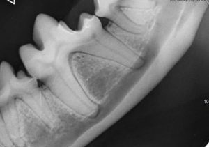 Dentisteria e Odontologia: Doença periodontal detetada por radiologia oral (imagem 1 de 2)