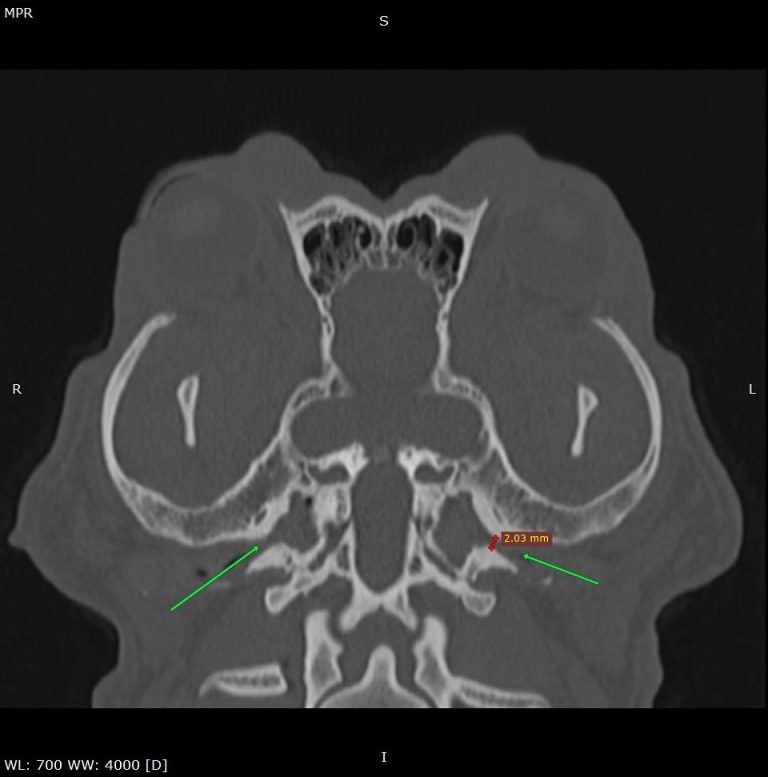 Medicina Interna: Braquicefalia e otites de difícil tratamento (imagem 1 de 3)