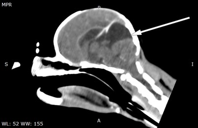 Imagiologia: Hidrocefalia em cão jovem de raça miniatura (imagem 1 de 2)