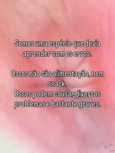 Endoscopia: Osso impactado no esófago removido por endoscopia (imagem 5 de 5)