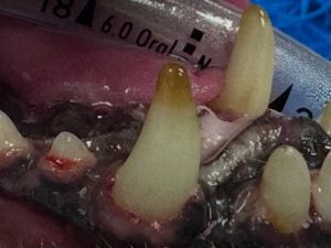 Dentisteria e Odontologia: Dente escurecido nem sempre está morto (imagem 1 de 2)