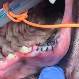 Dentisteria e Odontologia: Extração fechada do quarto pré-molar maxilar (imagem 2 de 2)
