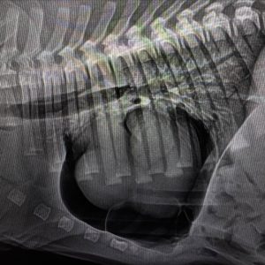 Medicina Interna: Pneumopericárdio após correção de hérnia