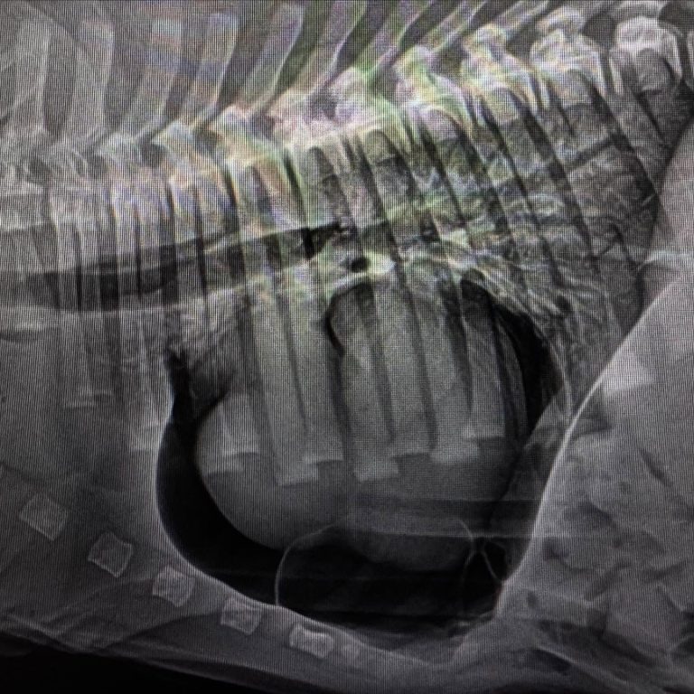 Medicina Interna: Pneumopericárdio após correção de hérnia