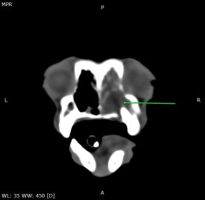 TAC: TAC revela abcesso periapical em Yorkshire