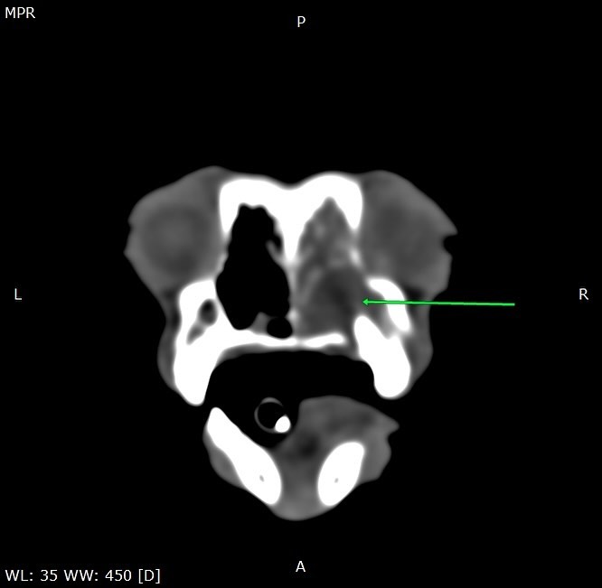 TAC revela abcesso periapical em Yorkshire